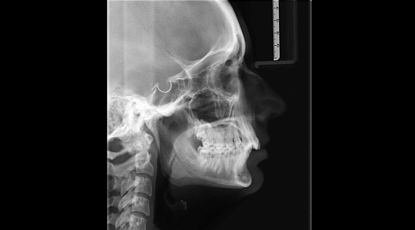 Fig. 3: Cephalometric radiograph.