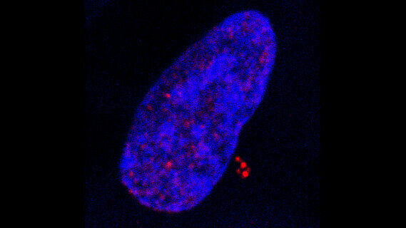 Infection par le virus d’Epstein-Barr: un nouveau mode de transformation cancéreuse