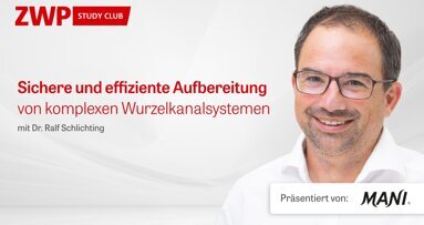 Webinar zur Aufbereitung von komplexen Wurzelkanalsystemen