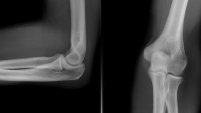 Nowa technologia wytwarzania kości