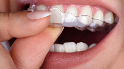 Launch of Aligner Dental Academy announced