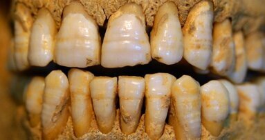 Ipoplasia dello smalto in un soggetto proveniente da un sito tardo medievale di Volpiano (To)