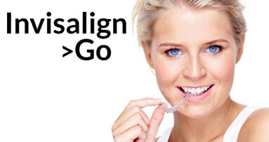Align extends Invisalign offering for GDPs