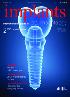 implants Poland No. 2, 2016 implants Poland No. 2, 2016