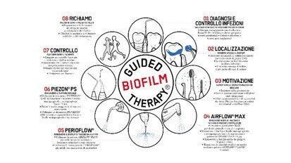 Alla conquista del biofilm sui brackets
