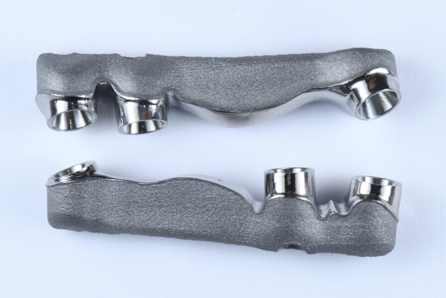 Fig. 13: Atlantis BridgeBase frameworks with angulated screw access holes at the second maxillary molar positions on both constructions.