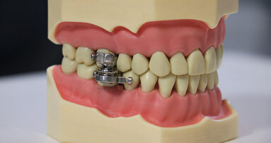 Kilo Vermek İsteyenler için Çene Kilidi