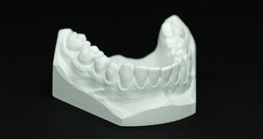 La forme de la mâchoire inférieure révèle les différences alimentaires