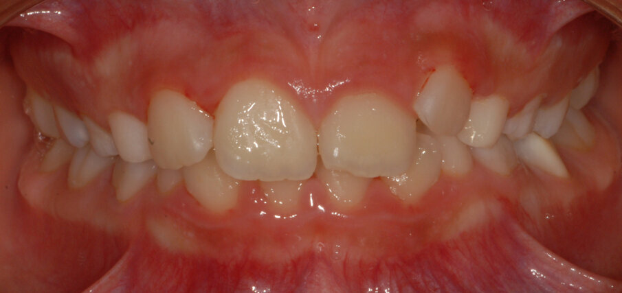 Fig. 13_Vista frontale iniziale.