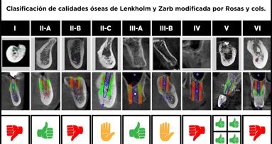Tecnologías de última generación para el manejo periodontal y perimplantar en paciente adulto mayor