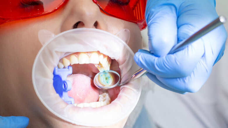 Dental caries prevalence continues to affect Australian adults, study says