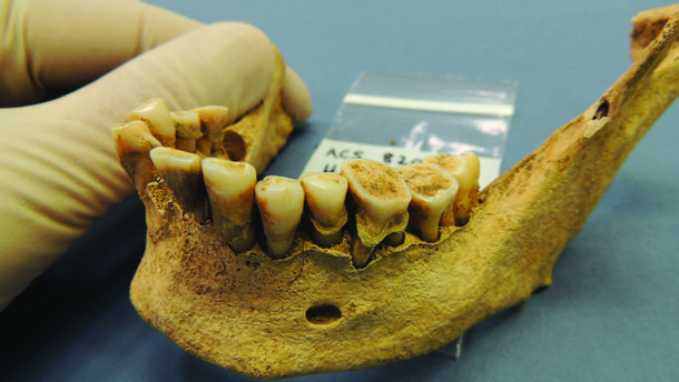 Istraživanje pokazuje kako pomak prema suvremenoj prehrani utječe na oralno zdravlje