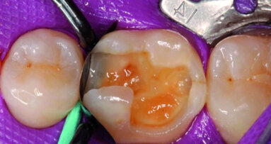Forme et couleur – facteurs également dans les matrices sectorielles ?