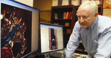 Le proteine ossee morfogenetiche potrebbero migliorare il successo del trattamento implantare