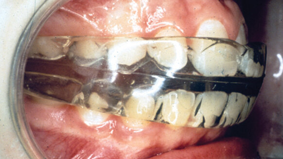 Preventive orthodontics: Is it a logical and predictive procedure?