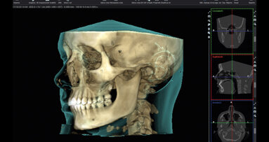 Utilizzo della tomografia computerizzata  a fascio conico, dei file STL  e dell’intelligenza artificiale