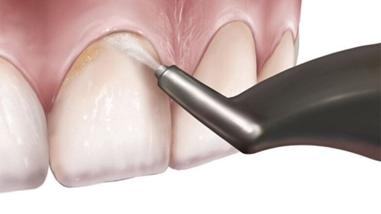 Erythritol functional roles in  oral-systemic health