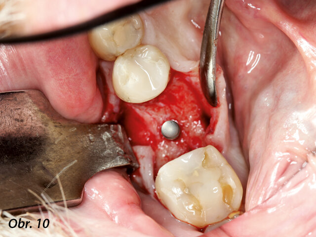 3D pozice ověřena paralelizačním pinem, okluzní pohled.