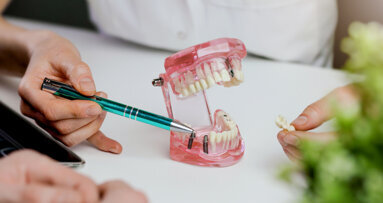 Early microbial determinants of peri-implant health discovered in a new study