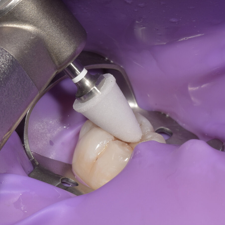 Fig 10: Polishing with  OneGloss Midi point 2in1 smart polisher