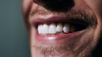 Column Reinier van de Vrie: Haye-tand