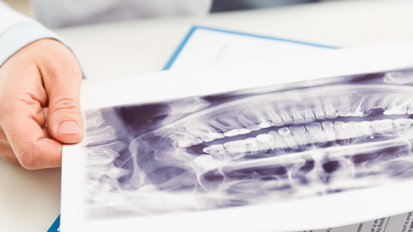 KZBV fordert unbürokratische Versorgung der Flüchtlinge