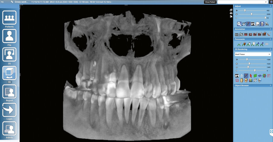 Fig. 2. DVT data set in the software program