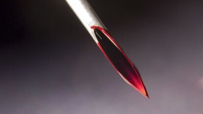 Onveranderd veel prikaccidenten in mondzorg