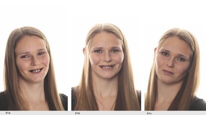 Una nueva sonrisa para Andrea