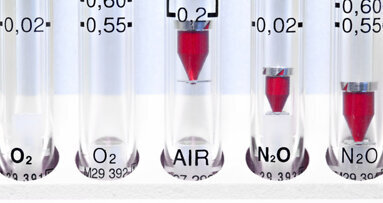 Österreichs Zahnärzte dürfen nicht parallel Lachgas verabreichen