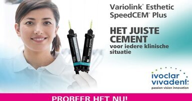 Bevestigingscement en bevestigingscomposiet: hoe maakt u de juiste keuze?
