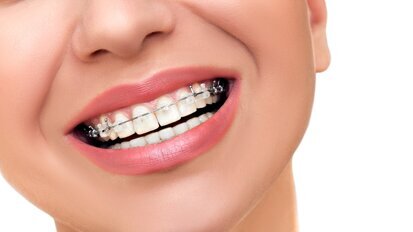 Orthodontics: Short-term gains … long-term problems?
