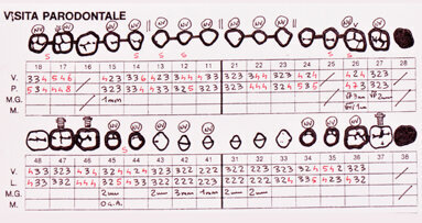 Riabilitazione complessa protesico-parodontale