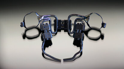 Il TSME (Transverse Sagittal Maxillary Expander) per il controllo tridimensionale del mascellare superiore