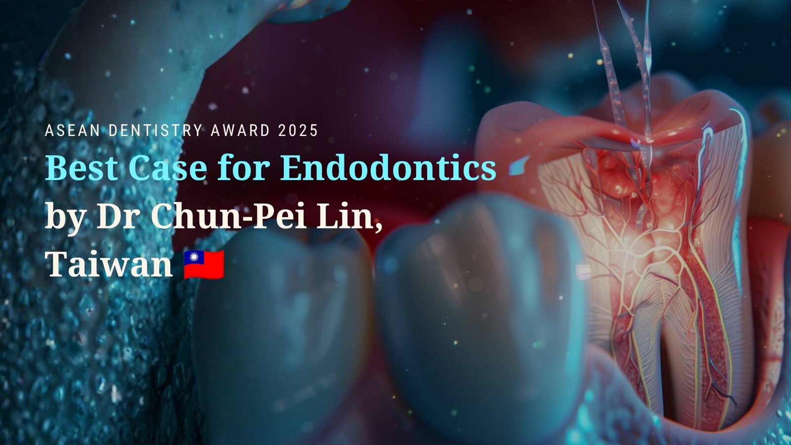 ASEAN Dentistry Award 2025 winners showcase: Best Case for Endodontics