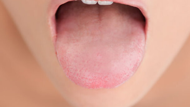 Η ξηροστομία αντικείμενο συζήτησης στο φόρουμ υγιεινής της Μεγάλης Βρετανίας