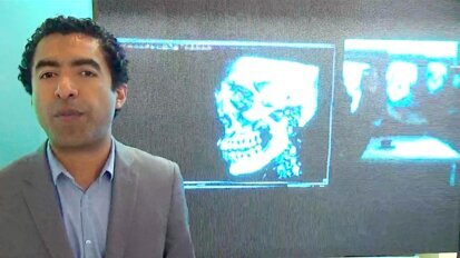 Acteon promueve en Nicaragua la unidad panorámica X Mind Trium