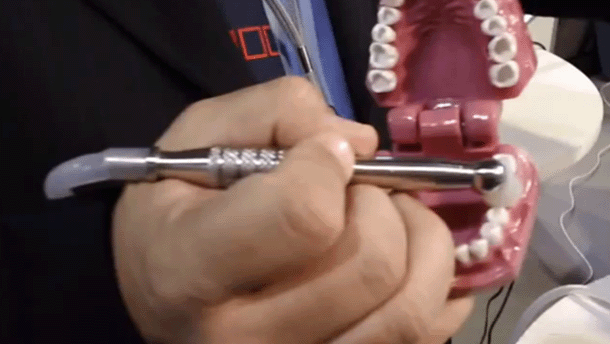 Las grandes ventajas del ozono para el tratamiento de la caries dental