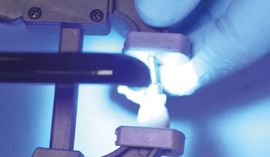 Fig. 11: Light-polymerise the excess cement for 2–5 seconds, depending on the curing light output and the distance at which it is held. 