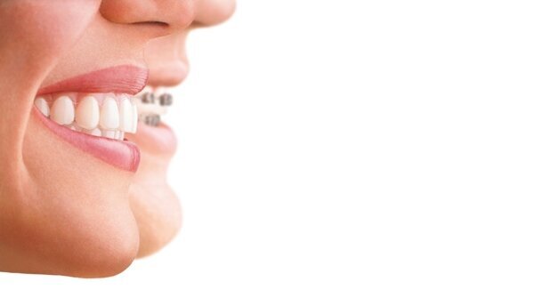 Invisalign opens first dedicated dental centre in Dubai