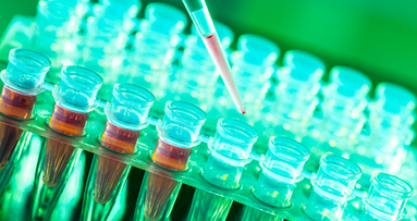 Krebs im Rachenraum: Neuer Bluttest bestimmt Risiko im Vorfeld