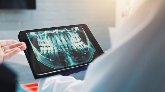 Pearl AI reveals hidden oral health crisis