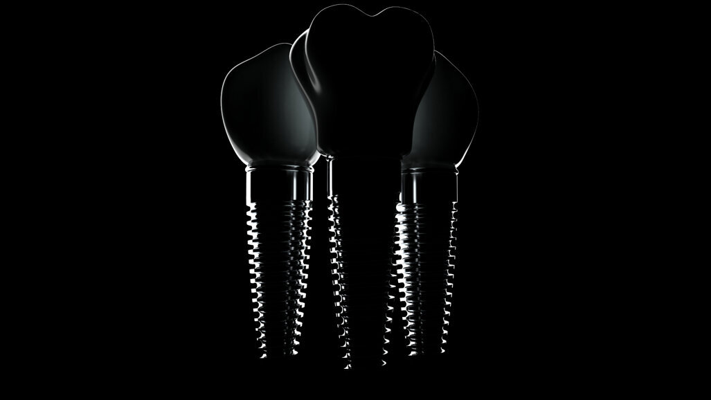 Neoss to host third Global Osseointegration Day on 3 May