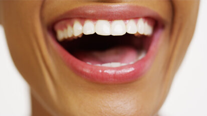 Oberstes Ziel: Verbesserung der Mundgesundheit