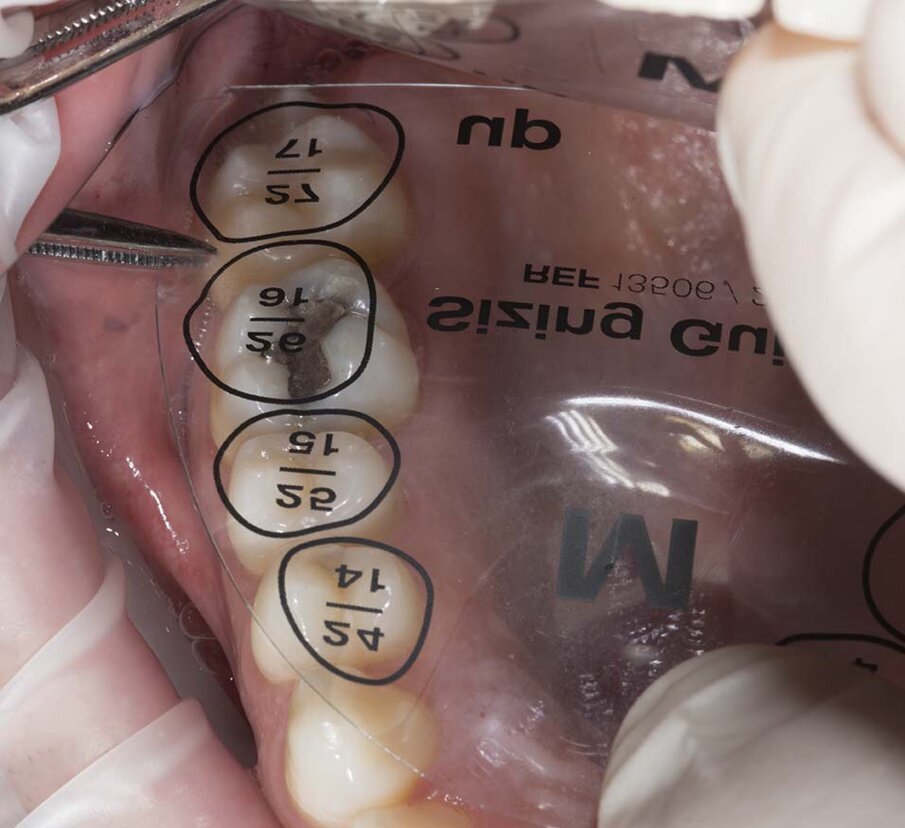 Fig. 3: Edelweiss Sizing Guide in small, medium and large size for crown size selection.