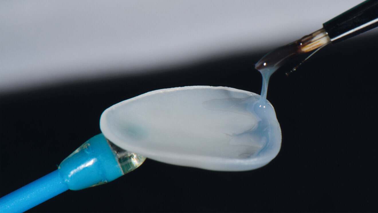 The edelweiss dentistry CAD/CAM BLOCK presents a breakthrough in the fabrication of CAD/CAM materials.