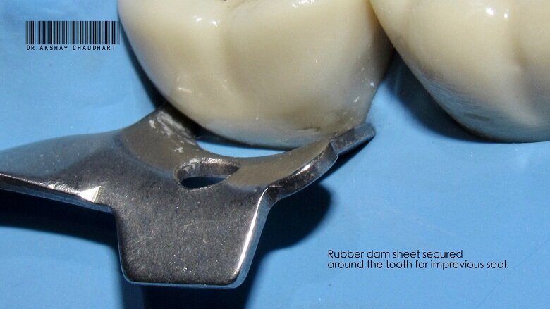 Fig - 4 Reposition the clamp