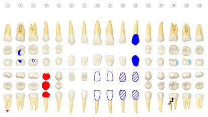 Henry Schein unveils beta version of cloud-based Dentrix Ascend practice management system Henry Schein unveils beta version of cloud-based Dentrix Ascend practice management system