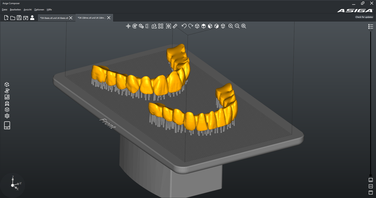 Fig. 4: Tooth segments with supporting structures on the build plate in the nesting software.