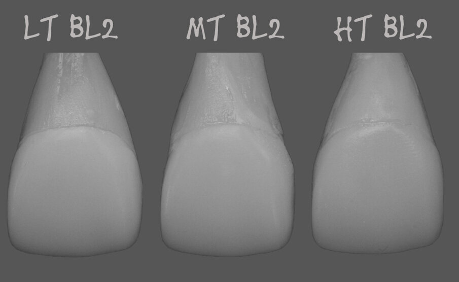 Fig.3b Same set-up in black and white (grey scale for evaluating the value). 